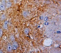 Polyclonal Antibody to Pleiotrophin (PTN)