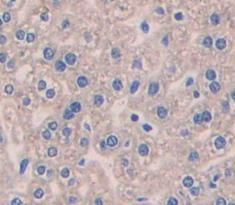 Polyclonal Antibody to Pleiotrophin (PTN)