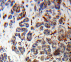 Polyclonal Antibody to Proopiomelanocortin (POMC)