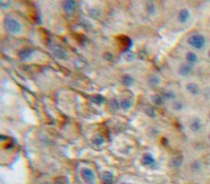 Polyclonal Antibody to Integrin Alpha 1 (ITGa1)