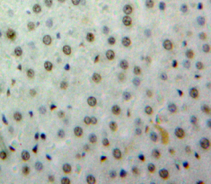 Polyclonal Antibody to Cyclic AMP Response Element Binding Protein (CREB)