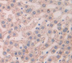 Polyclonal Antibody to Thymic Stromal Lymphopoietin (TSLP)