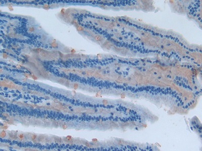 Polyclonal Antibody to Involucrin (INV)