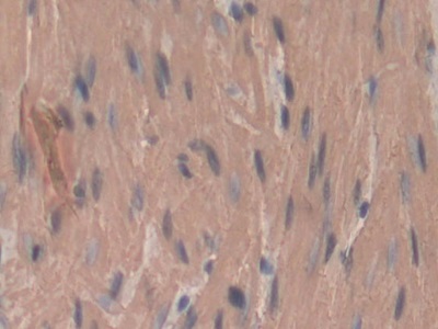 Polyclonal Antibody to Actin Alpha 2, Smooth Muscle (ACTa2)