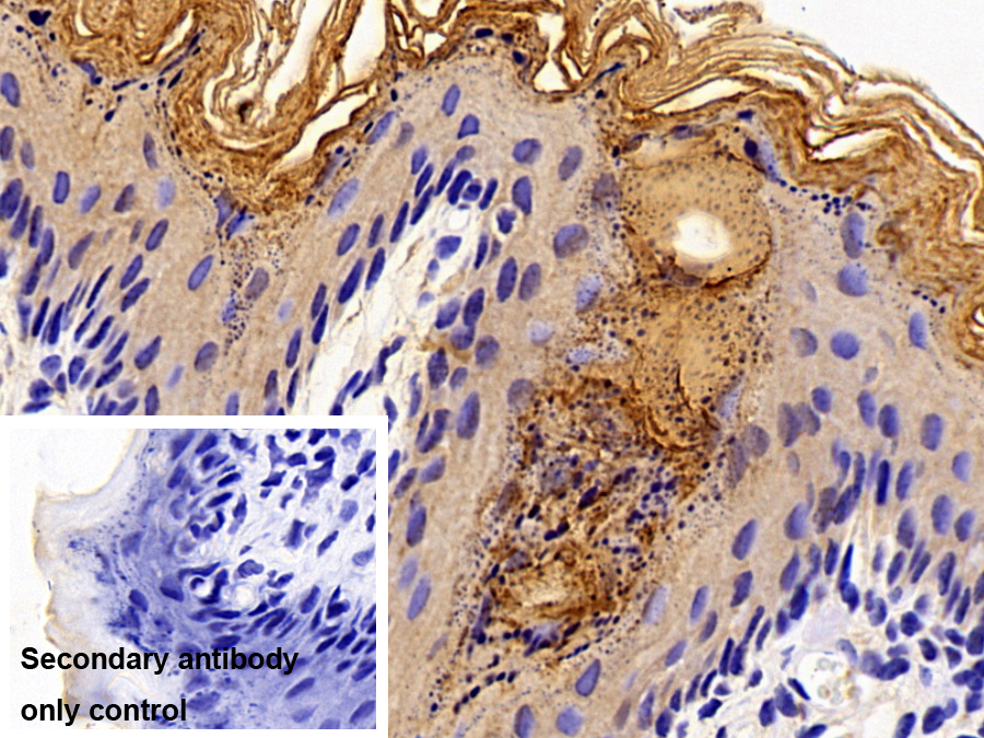 Polyclonal Antibody to Bcl2 Associated X Protein (Bax)