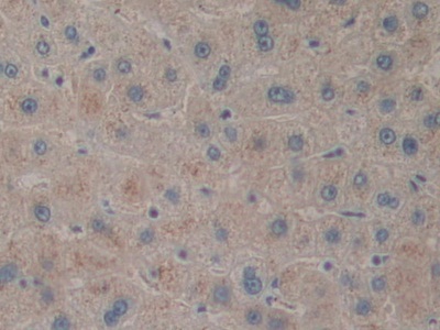 Polyclonal Antibody to Pituitary Adenylate Cyclase Activating Peptide (PACAP)