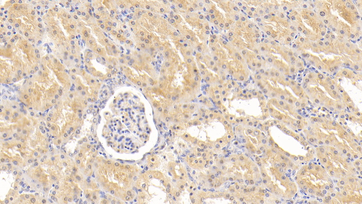 Polyclonal Antibody to Adipose Differentiation Related Protein (ADRP)