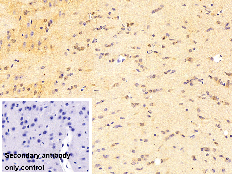 Polyclonal Antibody to Aryl Hydrocarbon Receptor (AhR)