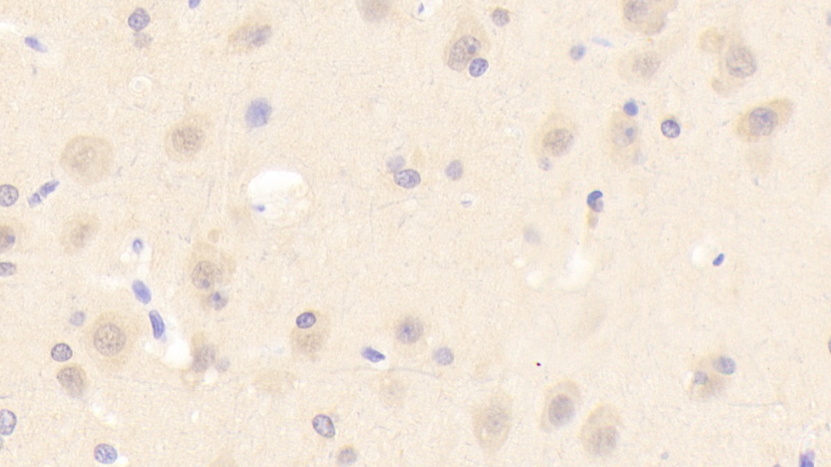 Polyclonal Antibody to Acid Sphingomyelinase (ASM)
