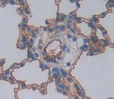 Polyclonal Antibody to Cluster Of Differentiation 74 (CD74)