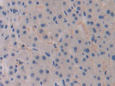 Polyclonal Antibody to Breast Cancer Susceptibility Protein 1 (BRCA1)