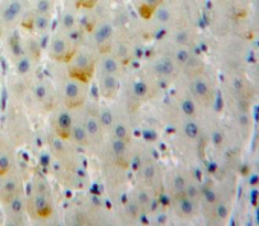 Polyclonal Antibody to Cluster of Differentiation 79B (CD79B)