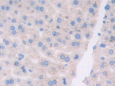 Polyclonal Antibody to Activating Transcription Factor 6 (ATF6)