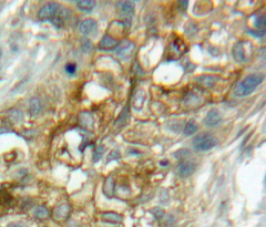 Polyclonal Antibody to Complement Component 1, Q Receptor (C1qR1)