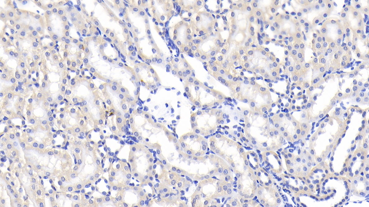 Polyclonal Antibody to Lipopolysaccharide Binding Protein (LBP)