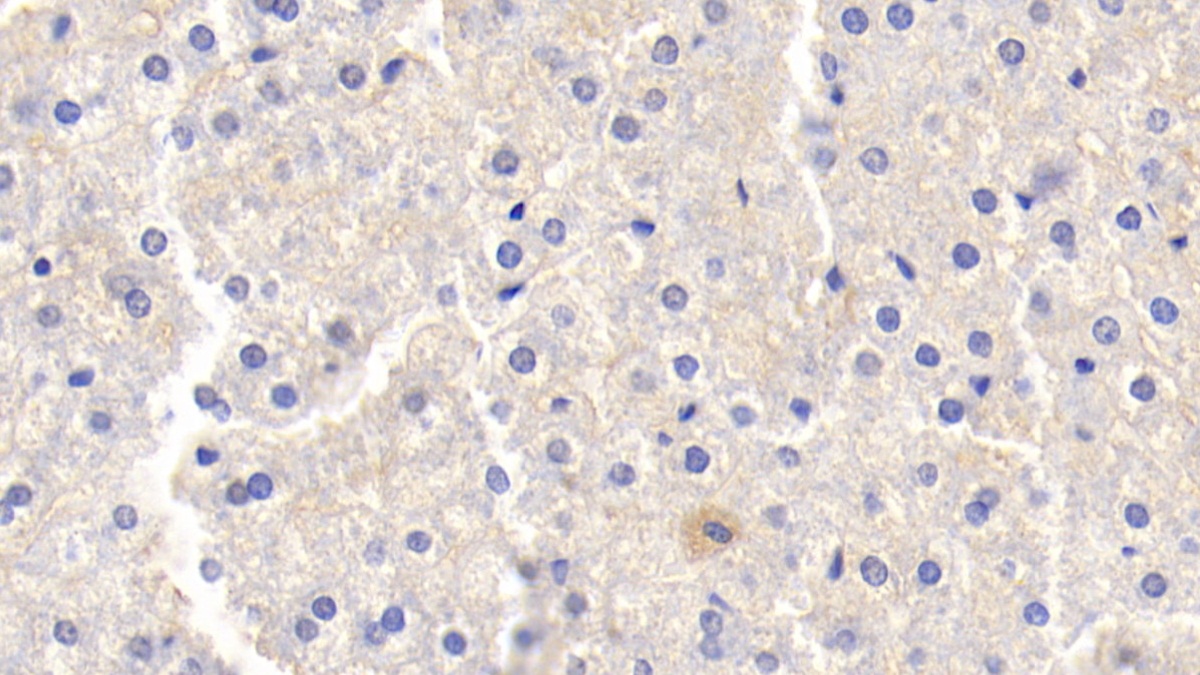 Polyclonal Antibody to Lipopolysaccharide Binding Protein (LBP)