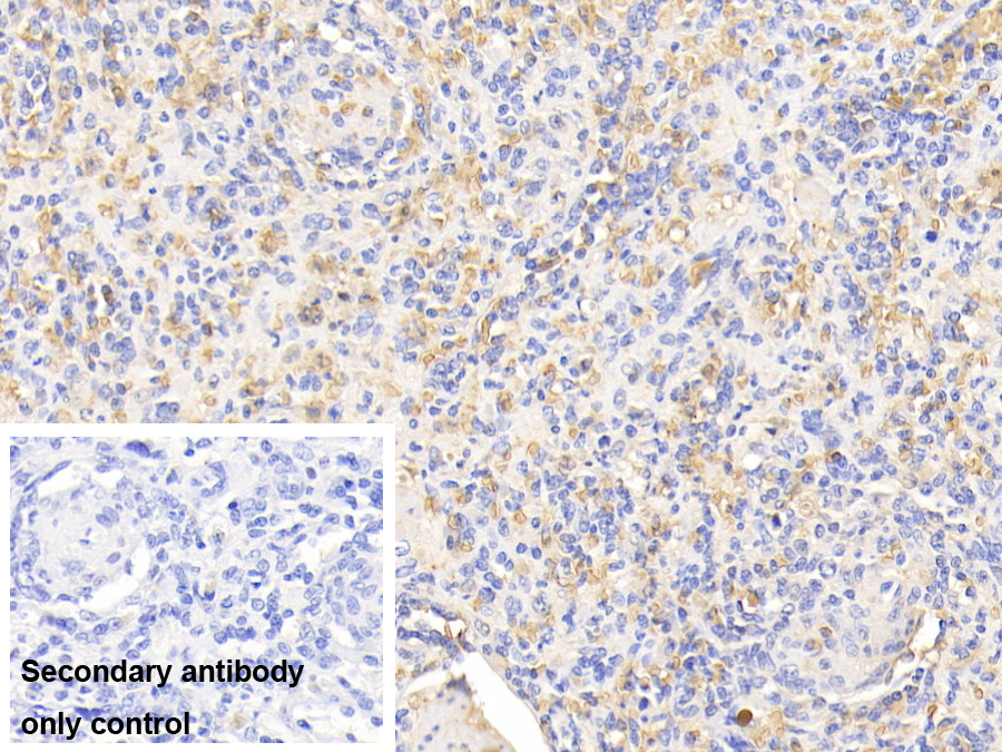 Polyclonal Antibody to Hemoglobin (HB)