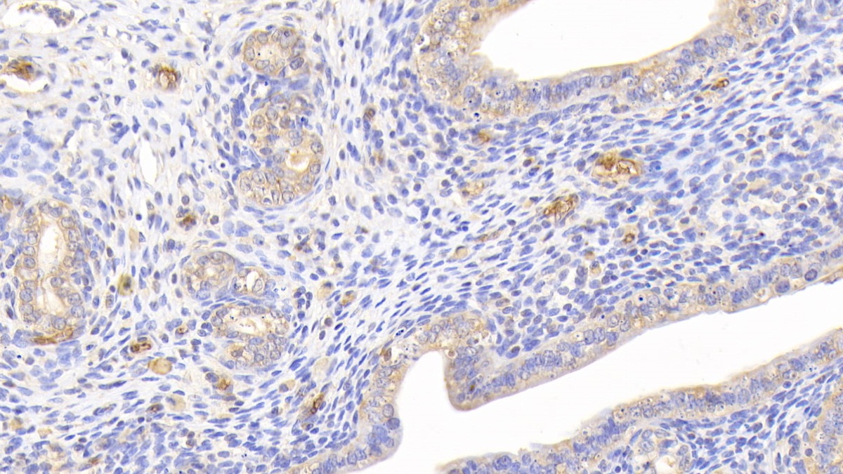 Polyclonal Antibody to Hemoglobin (HB)