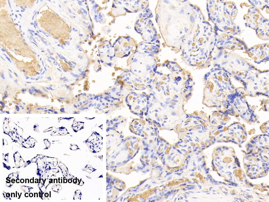 Polyclonal Antibody to Hemoglobin (HB)