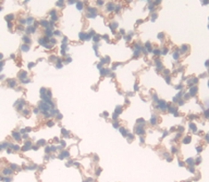 Polyclonal Antibody to Cluster Of Differentiation 97 (CD97)