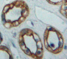 Polyclonal Antibody to Adenylate Cyclase 5 (ADCY5)