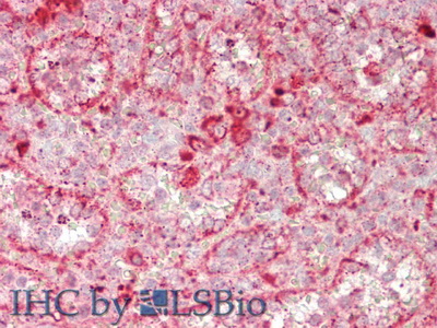 Polyclonal Antibody to Glucuronidase Beta (GUSb)