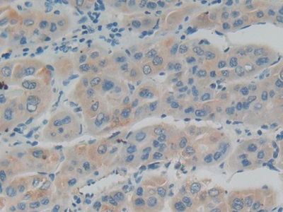 Polyclonal Antibody to Interferon Alpha/Beta Receptor 1 (IFNa/bR1)