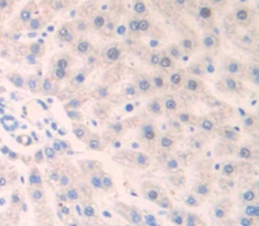 Polyclonal Antibody to Interferon Alpha/Beta Receptor 1 (IFNa/bR1)