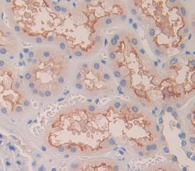 Polyclonal Antibody to Cluster Of Differentiation 99 (CD99)