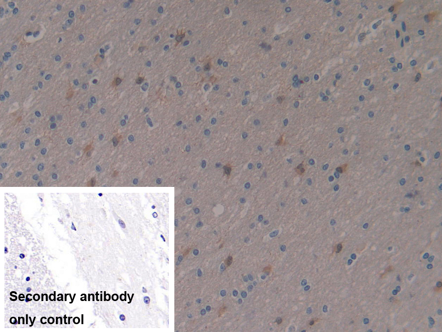 Polyclonal Antibody to Enolase 3 (ENO3)