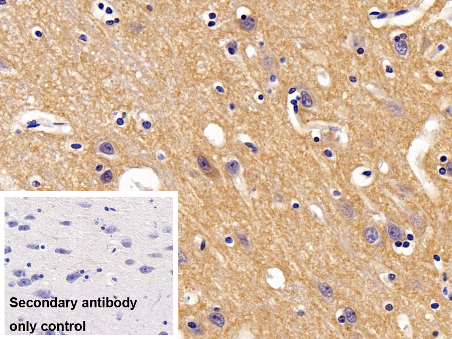 Polyclonal Antibody to Relaxin/Insulin Like Family Peptide Receptor 1 (RXFP1)