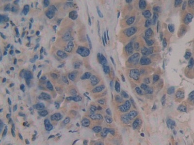 Polyclonal Antibody to Cluster Of Differentiation 109 (CD109)