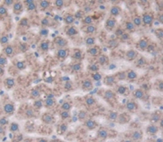 Polyclonal Antibody to Cluster Of Differentiation 109 (CD109)