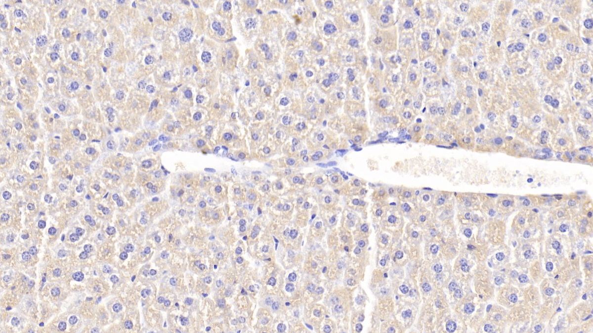 Polyclonal Antibody to Chitinase-3-like Protein 1 (CHI3L1)