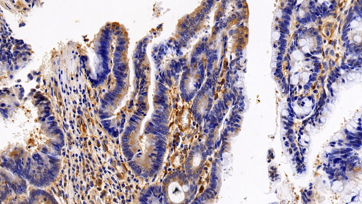 Polyclonal Antibody to Colony Stimulating Factor Receptor, Granulocyte (GCSFR)