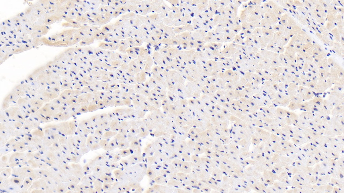 Polyclonal Antibody to Calreticulin (CALR)