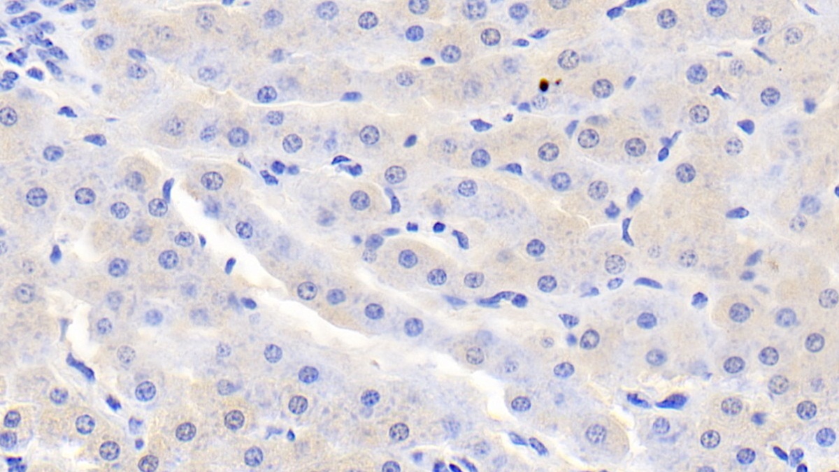 Polyclonal Antibody to Sorbitol Dehydrogenase (SDH)