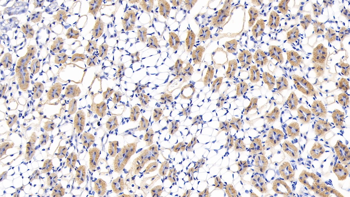 Polyclonal Antibody to Lumican (LUM)