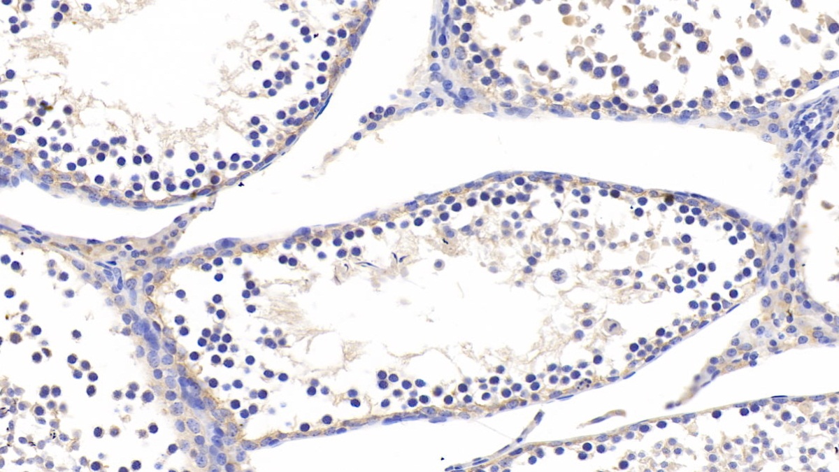 Polyclonal Antibody to Tumor Necrosis Factor Receptor 1 (TNFR1)