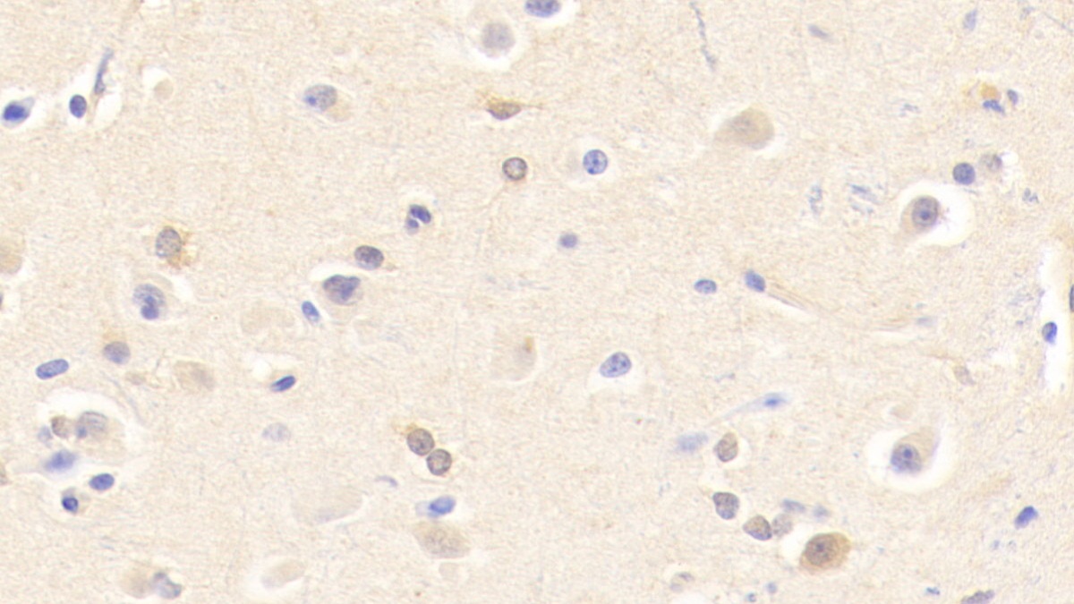 Polyclonal Antibody to Cholinergic Receptor, Nicotinic, Beta 2 (CHRNb2)