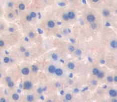 Polyclonal Antibody to Serum Amyloid P Component (SAP)