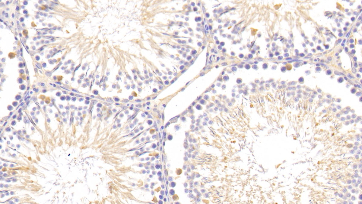 Polyclonal Antibody to Serum Amyloid P Component (SAP)