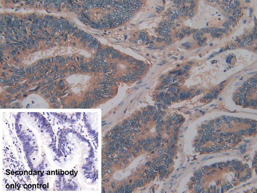 Polyclonal Antibody to Cluster Of Differentiation 147 (CD147)