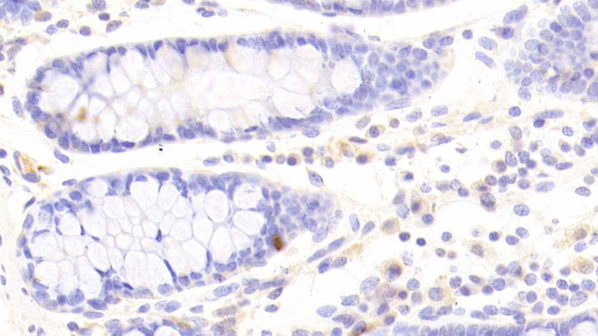 Polyclonal Antibody to Indoleamine-2,3-Dioxygenase (IDO)