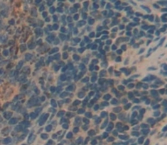 Polyclonal Antibody to Killer Cell Immunoglobulin Like Receptor 2DS4 (KIR2DS4)