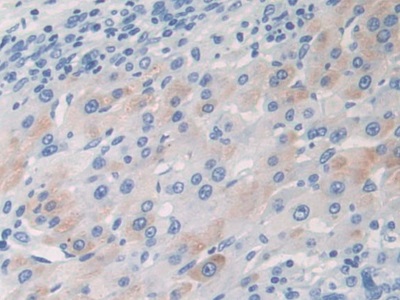 Polyclonal Antibody to Thymus Activation Regulated Chemokine (TARC)