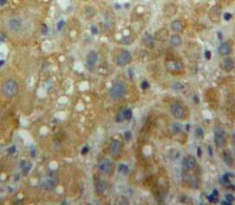 Polyclonal Antibody to Lymphocyte Function Associated Antigen 1 Alpha (CD11a)