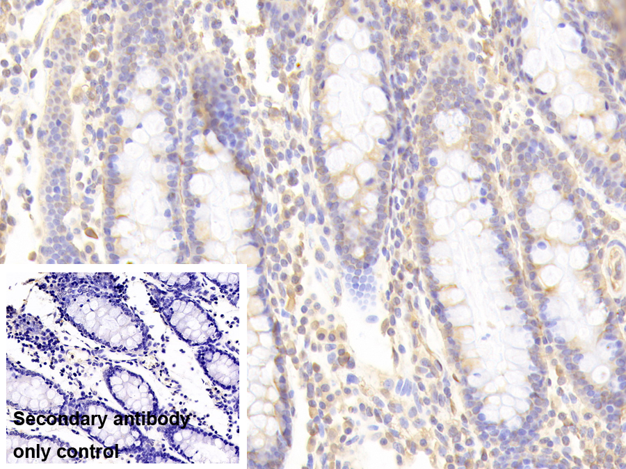 Polyclonal Antibody to Mucosae Associated Epithelia Chemokine (MEC)