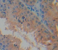 Polyclonal Antibody to Mucosae Associated Epithelia Chemokine (MEC)