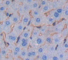 Polyclonal Antibody to Cluster Of Differentiation 2 (CD2)
